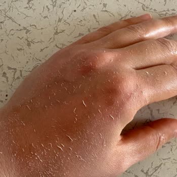 Bioderma Photoderm Spot SPF 50+ Ürünün Şişik Paketi Ve Bozuk Kıvamı, İade Talebi