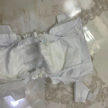 Molfix Bebek Bezinde Bant Yırtığı Nedeniyle Kullanılamaz Olması Ve Ürün Değişimi Talebi