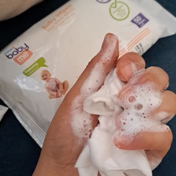 Zeytinyağlı Islak Mendilde Şiddetli Pişik: Bebek Sağlığı Tehlikede Ve Ebebek Yanıtsız