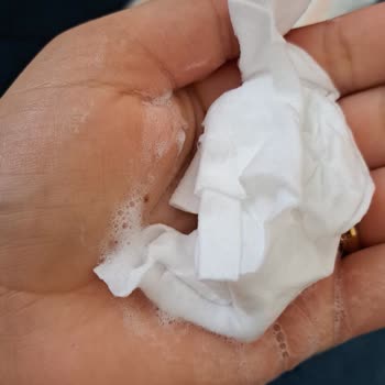 Zeytinyağlı Islak Mendilde Şiddetli Pişik: Bebek Sağlığı Tehlikede Ve Ebebek Yanıtsız