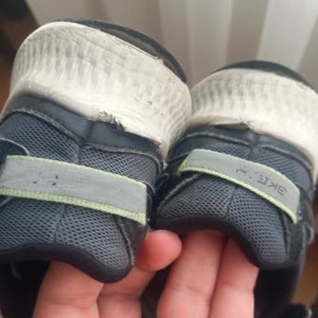 Kısa Sürede Üretim Hatası: Skechers Ayakkabısında Dikiş Kopması Ve İade Talebi