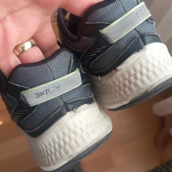 Kısa Sürede Üretim Hatası: Skechers Ayakkabısında Dikiş Kopması Ve İade Talebi
