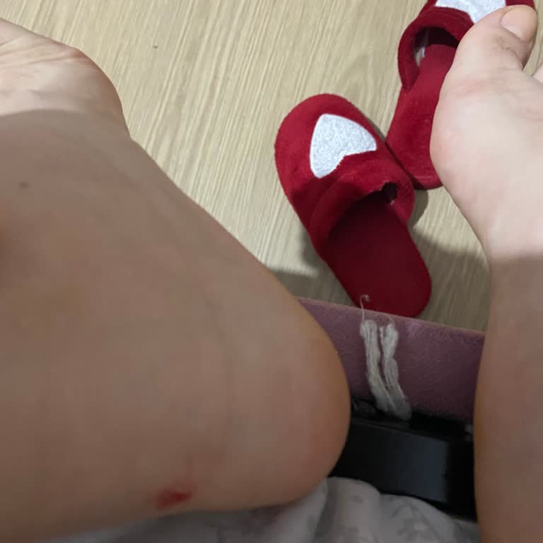 Ayaklarım Yanıyor, Kutu Olmadan İade Talebim Reddedildi