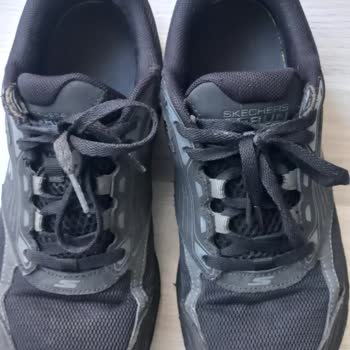 Skechers Run Ayakkabısında Hızlı Yıpranma Ve Kullanıcı Hatası İddiasına Karşı Değişim Talebi