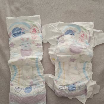 Molfix Bebek Bezlerinde Yanlış Boyutlu Ürünler Ve Toplu Alımda Yaşanan Mağduriyet