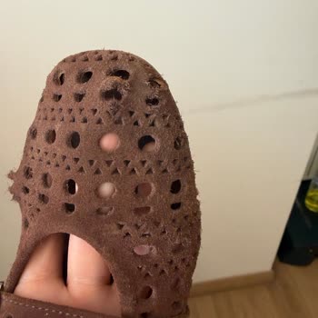 Desa Süet Babette Deri Soyulması Ve Mağazanın Çözüm Sunmaması