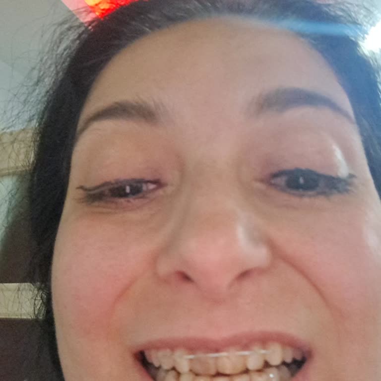 Vanilya Diş Kliniği | Büyükçekmece Mağduriyet Yaşama