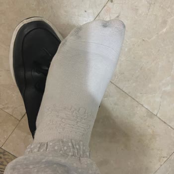 FLO Ayakkabı Outlet'ta Satın Alınan Deri Ayakkabıda Boya Vermesi Ve Garanti Değişim Reddi