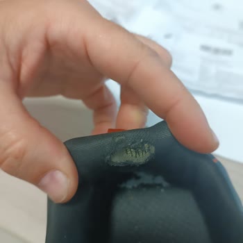 Kısa Sürede Deforme Olan Skechers Ayakkabı İçin Garanti Uygulanmadı