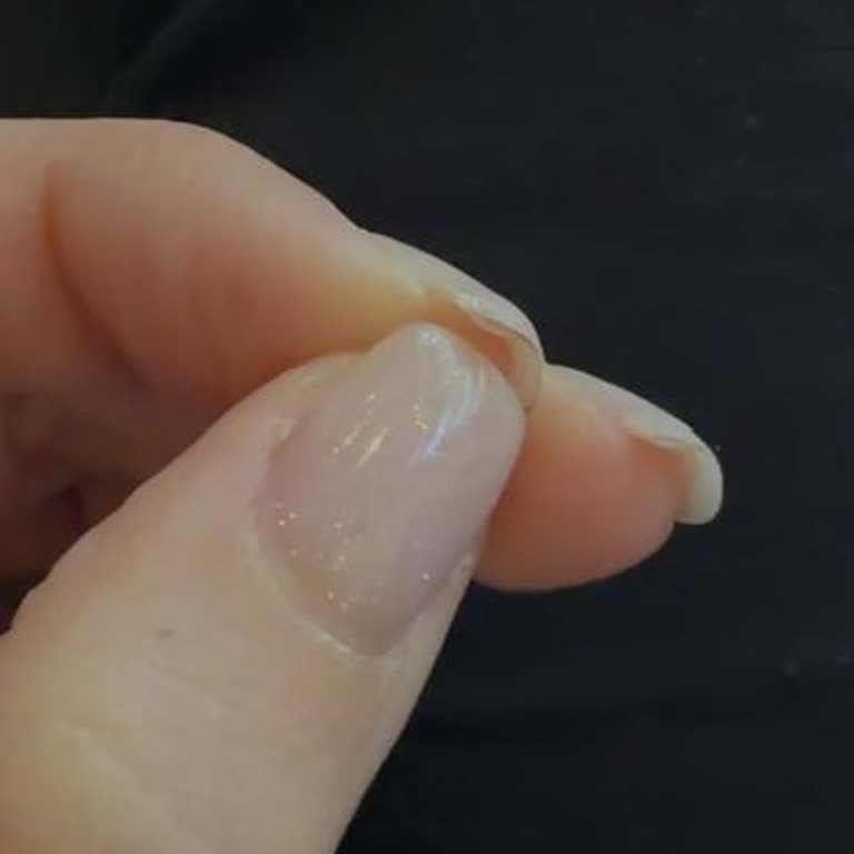 Gis Nail Bar Hatalı Oje Sonrası Ücretli Bakım Teklifi Müşteriyi Hayal Kırıklığına Sürdü
