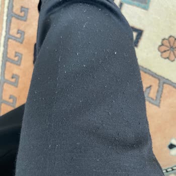 Altınyıldız Takım Elbisede Hızlı Tüylenme Ve Güven Kaybı