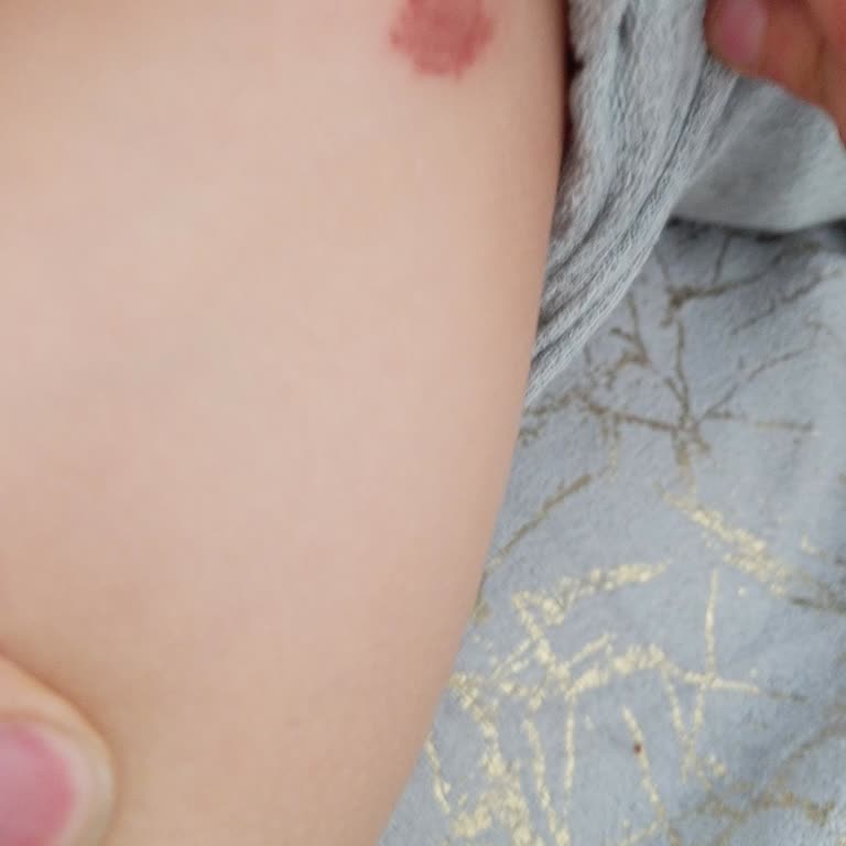 Okul Bahçesinde Fiziksel Şiddet Ve Güvenlik Zafiyeti