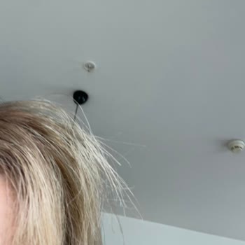 DMR Hair'de 23.000 TL'lik Saç İşlemi Sonrası Aşırı Hasar Ve İade Talebi