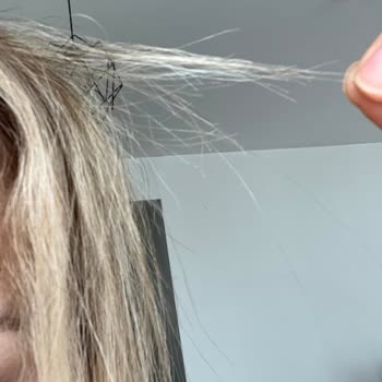 DMR Hair'de 23.000 TL'lik Saç İşlemi Sonrası Aşırı Hasar Ve İade Talebi