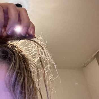 DMR Hair'de 23.000 TL'lik Saç İşlemi Sonrası Aşırı Hasar Ve İade Talebi