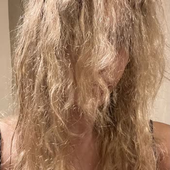 DMR Hair'de 23.000 TL'lik Saç İşlemi Sonrası Aşırı Hasar Ve İade Talebi