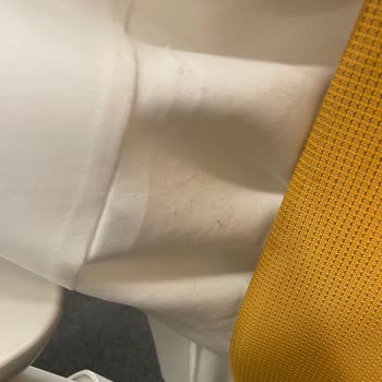 Lacoste Üstünde 5 Saatlik Kullanımda Aşırı Tüylenme Ve Şirketin Haksız Açıklaması