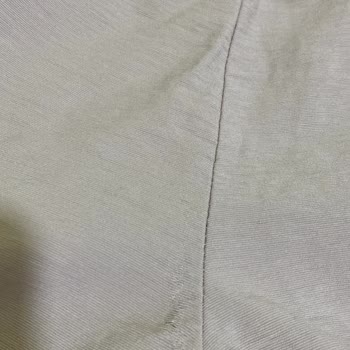 Pantolonun Kumaşı Hemen Yırtıldı, Hızlı Değişim Bekliyorum