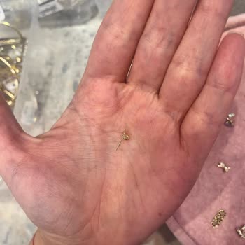 Kokoş Mağazasında Kusurlu Piercing Değişim İsteği Hijyen Gerekçesiyle Reddedildi