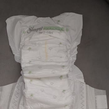 Üretim Hatası: Yan Kulak Olmayan Bebek Bezlerinde Sızıntı Sorunu