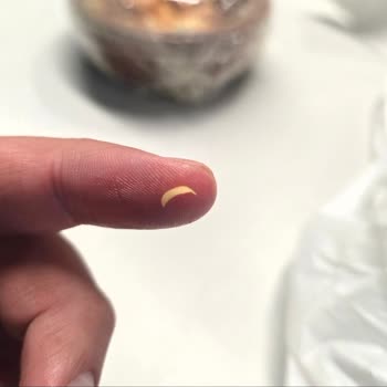 Mersin Yaprak Tantuni Şubesinde Tantuni İçinde Keskin Yabancı Cisim Ve Hijyen İhlali