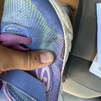Boyner'den Alınan Skechers Işıklı Ayakkabının Hızlı Açılma Ve Garanti Redleri