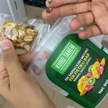 Kuru Tanem Barında Taş Çıktı, Diş Kırıldı