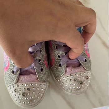 Skechers Çocuk Ayakkabısının Dil Çökmesi Çocuğun Ayağını Acıtıyor