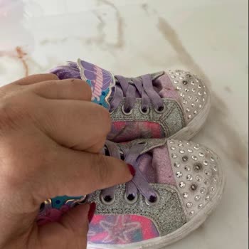 Skechers Çocuk Ayakkabısının Dil Çökmesi Çocuğun Ayağını Acıtıyor