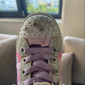 Skechers Çocuk Ayakkabısının Dil Çökmesi Çocuğun Ayağını Acıtıyor