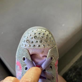Skechers Çocuk Ayakkabısının Dil Çökmesi Çocuğun Ayağını Acıtıyor