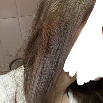 Saçlarım Yanıp Kökünden Çıktı, Ücret Üç Kat Arttı, Kuaförde Profesyonellik Yok