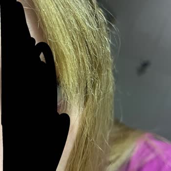 Saçlarım Yanıp Kökünden Çıktı, Ücret Üç Kat Arttı, Kuaförde Profesyonellik Yok