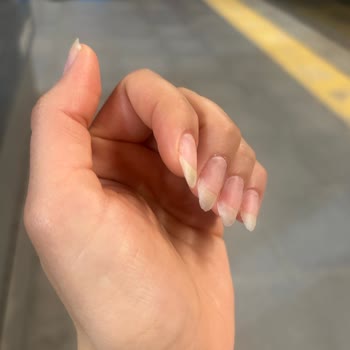 Sia Beauty & Academy Kaba Muamele Gördüm!
