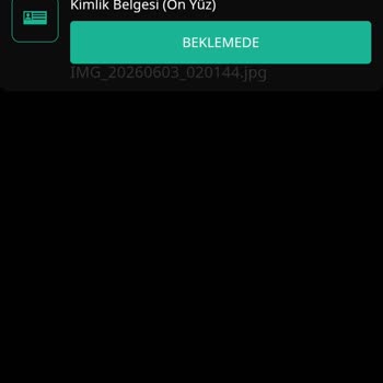Belge Onayı Gecikti, 11.000 TL Çekimim Hâlâ Beklemede