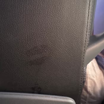 Otobüste Kötü Koku Ve Hijyen Eksikliği