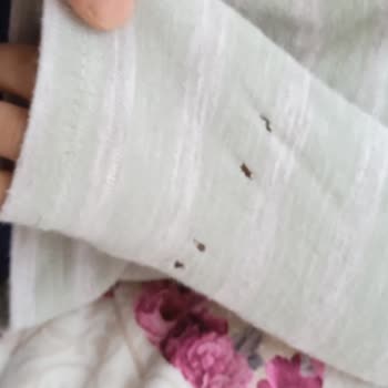 Bebek Kazak Setinde Delik Ve Aşırı Tüylenme, Testten Geçti Etiketi Yanıltıcı