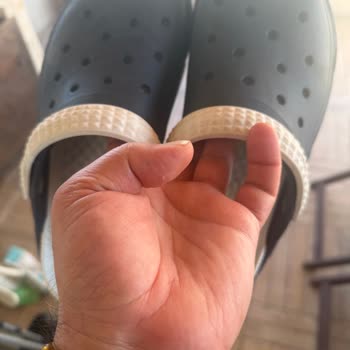 Kapalı Terlikte Tekrarlayan Alerjik Yaralar Ve Üretici Cevapsızlığı