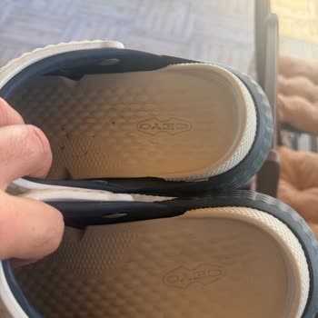 Kapalı Terlikte Tekrarlayan Alerjik Yaralar Ve Üretici Cevapsızlığı