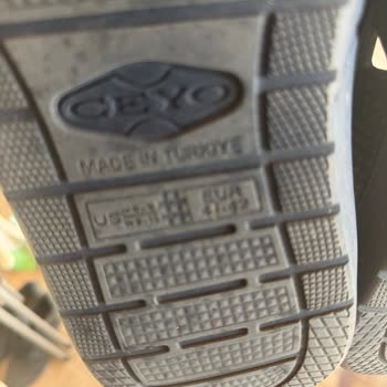 Kapalı Terlikte Tekrarlayan Alerjik Yaralar Ve Üretici Cevapsızlığı