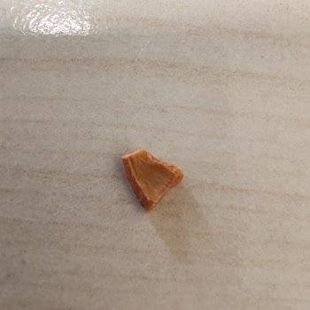Migros MJet Ürününün İçindeki Ceviz Kabuğu Dişimi Yaraladı