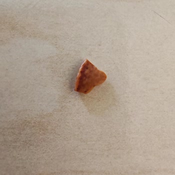 Migros MJet Ürününün İçindeki Ceviz Kabuğu Dişimi Yaraladı