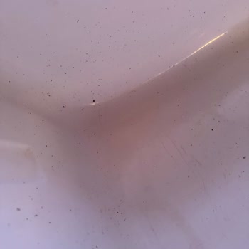 Jakuzide Hijyen Eksikliği Ve İade Sorunu