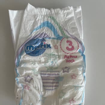 Molfix Bebek Bezlerinde Arka Elastik Olmaması Nedeniyle Sızıntı Şikayeti