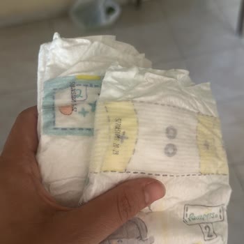 İki Paketteki Bezler Farklı, Mavi Koruma Bandı Yok Bebek Sağlığı Endişesi Ve Değişim Talebi