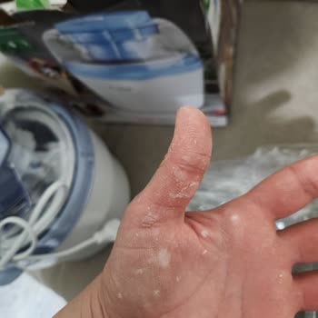Kivi Dondurma Makinesi Hasarı Nedeniyle İade Talebinin Haksız Reddi