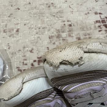 Skechers Çocuk Ayakkabısının Bir Yıla Dönmeden Parçalanması Ve Garanti Reddi