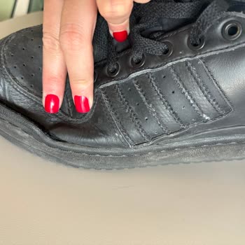 3000 TL'lik Adidas Ayakkabının Kısa Sürede Açılması Ve Mağaza Tarafından Kullanıcı Hatası İddiası