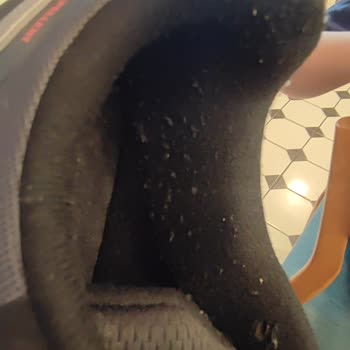 Adidas Ayakkabısının Topuk Bölümünde Erken Tiftiklenme Ve Değişim İsteği
