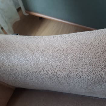 Defolu Ve Yanlış Parçalı Berjerler İçin İade Ve Değişim Talebi